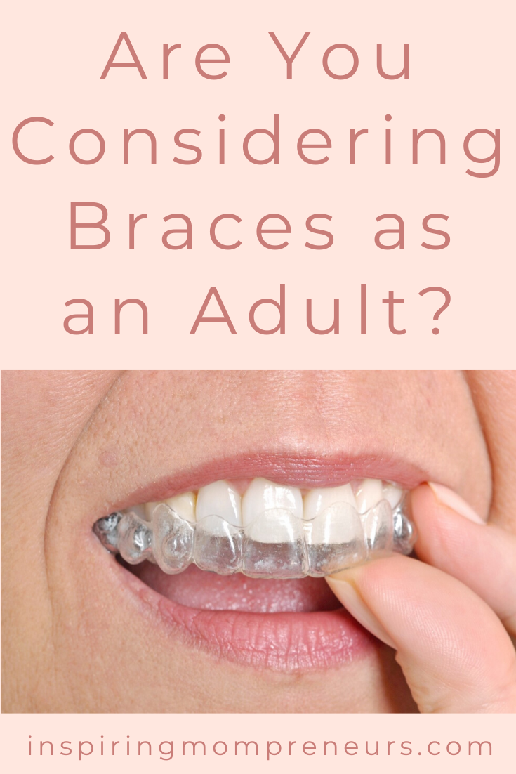 One in every five individuals past adolescence takes steps to correct their misaligned teeth.  Most prefer discreet aligners.  Fortunately, braces have come a long way.  Read on... #clearbraces #modernbraces #orthodontics #modernorthodonticoptions