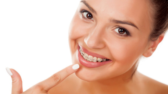 Are You Considering Braces as an Adult?