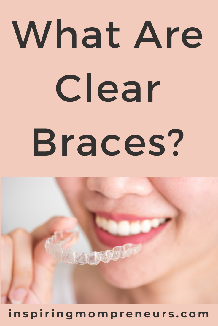 What are clear braces? Clear braces are an alternative to metal braces to align your teeth. They are almost invisible, don't have wires or brackets and most of them are removable.Here are some of the different types of clear braces available.