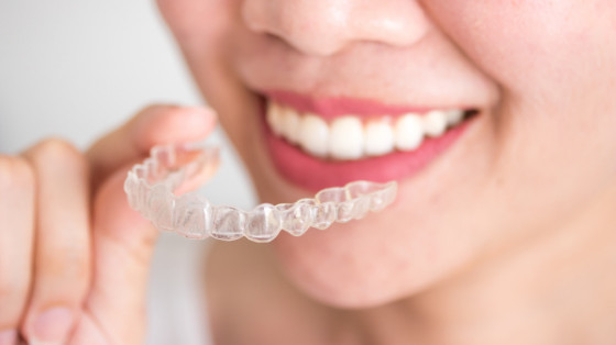 What are Clear Braces?
