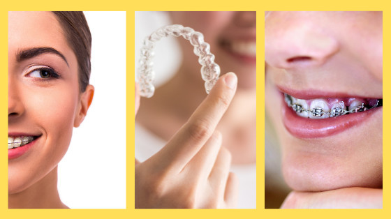 different orthodontic treatments