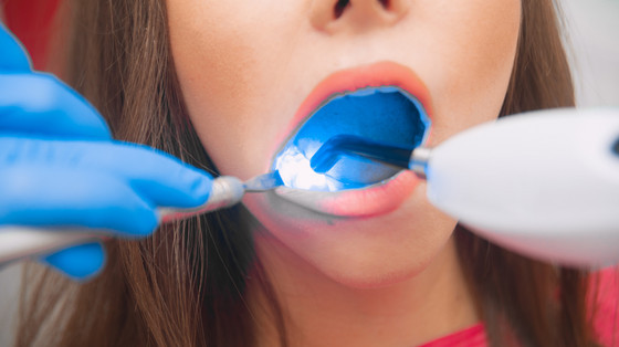 8 Advantages of Lasers in Dentistry