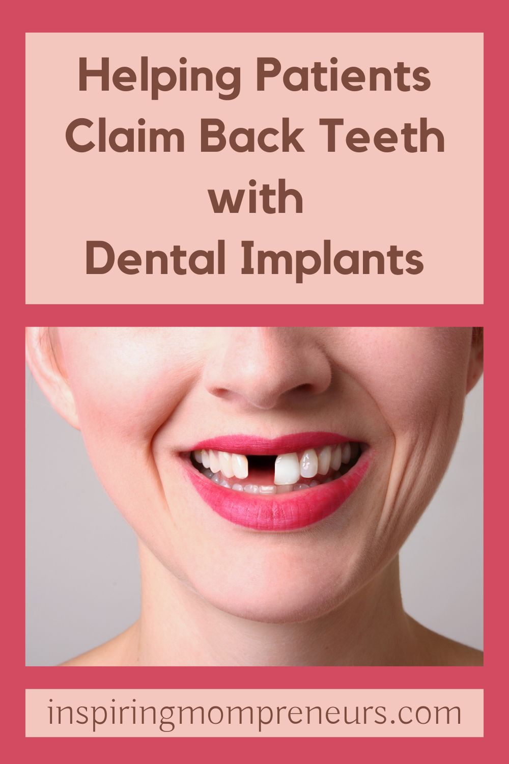 Helping Patients Claim Back Teeth_pin