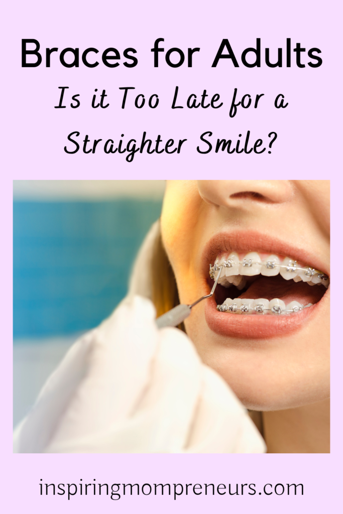 Is it Too Late for a Straighter Smile | Braces for Adults