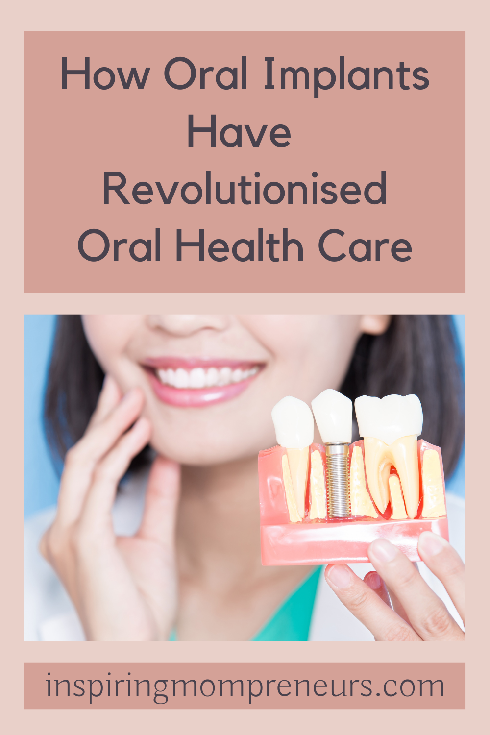 How Oral Implants Have Revolutionised Oral Health Care | Oral Implants pin