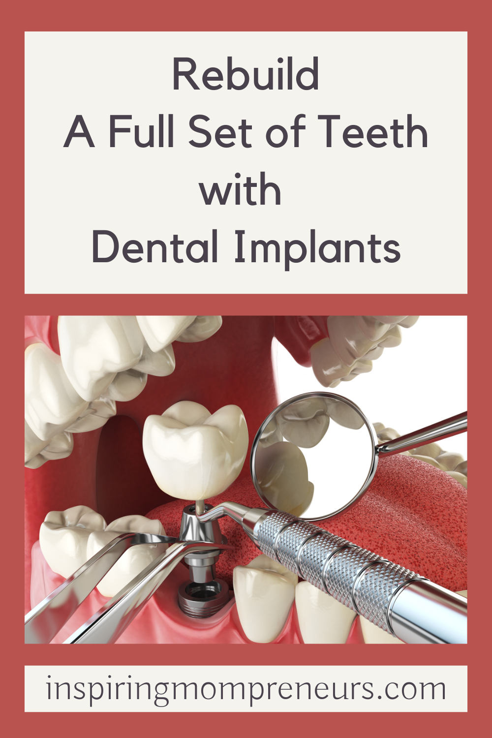 When you have had an accident or taken a blow to the mouth, the best option is likely to be to rebuild a full set of teeth with dental implants. Read more...