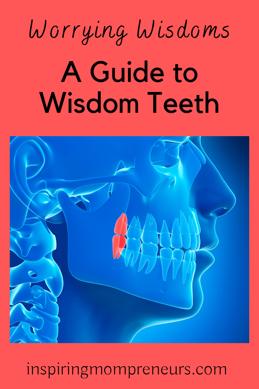 Worrying Wisdoms: A Guide to Wisdom Teeth | guide to wisdom teeth pin