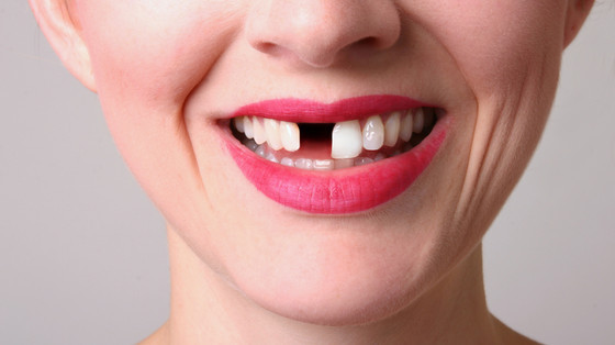 Helping patients claim back their teeth