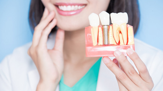 How Oral Implants Have Revolutionised Oral Health Care