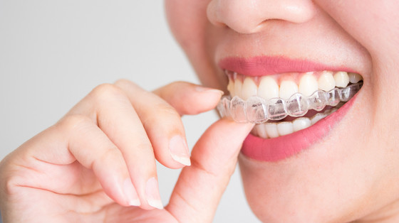 Improving Oral Health with Invisalign