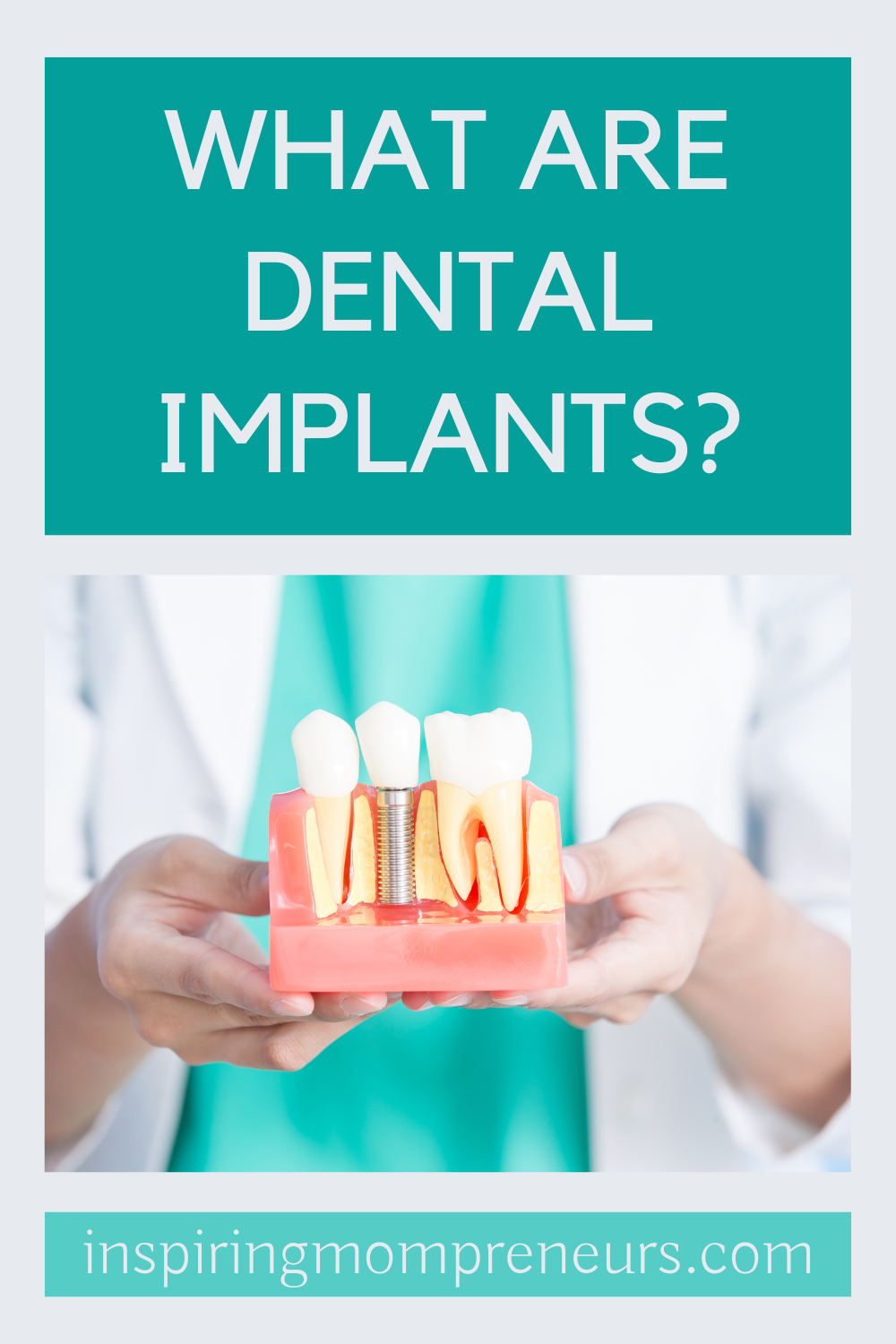 What are Dental Implants? Plus 4 Top Advantages