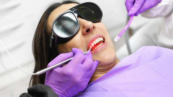 What are the Advantages of Lasers in Dentistry?