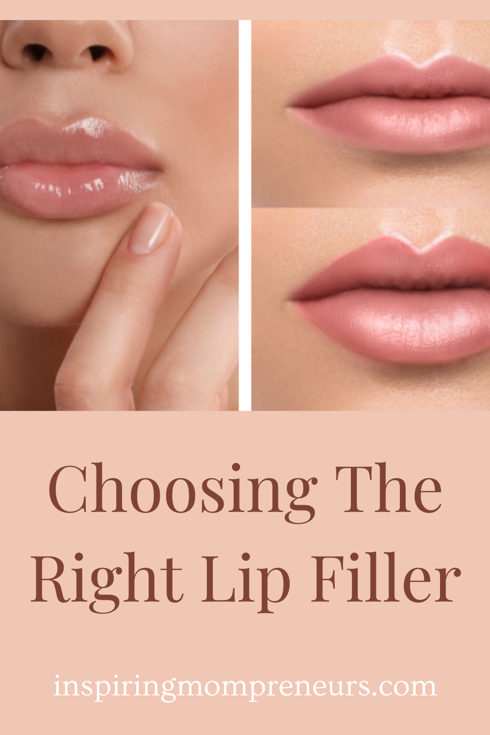 Hey there, beauty enthusiasts! Ever thought about giving your lips a little extra oomph? Here's everything you need to know about choosing the right lip filler.